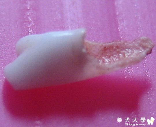 撿到乳牙:) (有一點點血絲!!)(原發表者:阿助)(醫療保健)