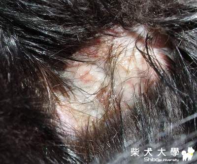 皮膚爛掉!!!拜託大家提供意見!(原發表者:福氣媽媽)(醫療保健)