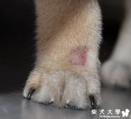 這是哪種皮膚病？？？(原發表者:帕克)(醫療保健)